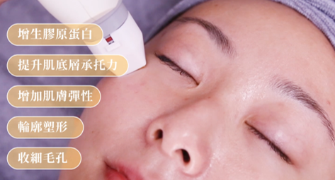 THER 膠原槍緊緻療程 ➡ ＄488 / 1️次 