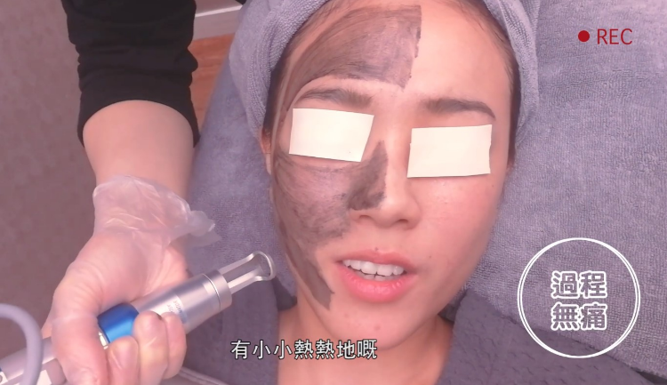 抗污染 • 淨化亮白療程  ➡ ＄188 / 1️次 ➡ ＄388 / 3次 