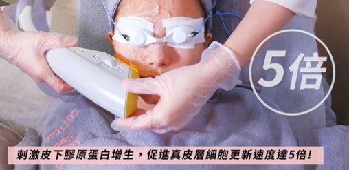 素顏嫩膚修復光 ➡$188/1次 ➡$488/3次 